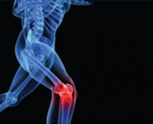 Paul Zaichik - Elastic Steel - Knee Injury For Martial Arts
